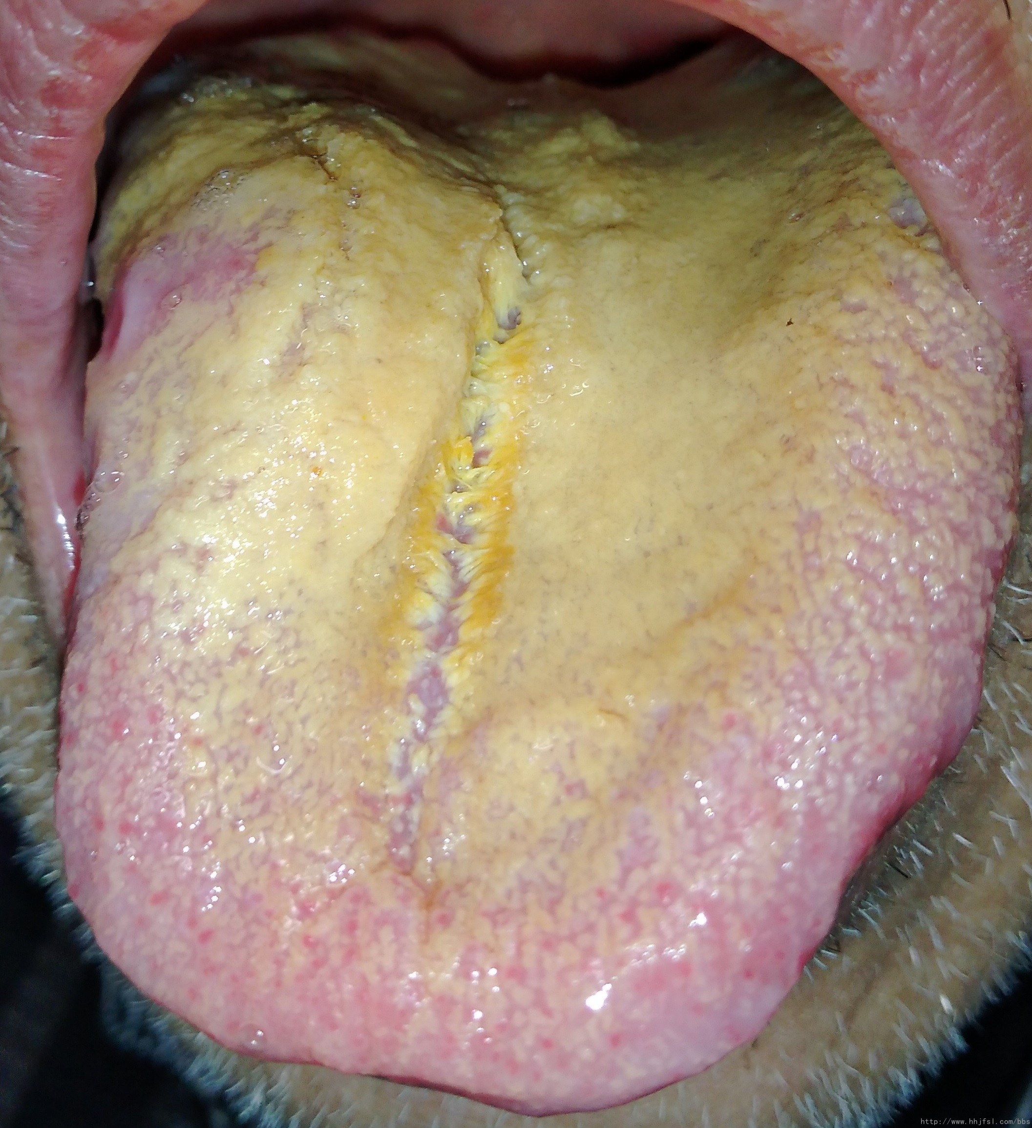 舌苔1.jpg