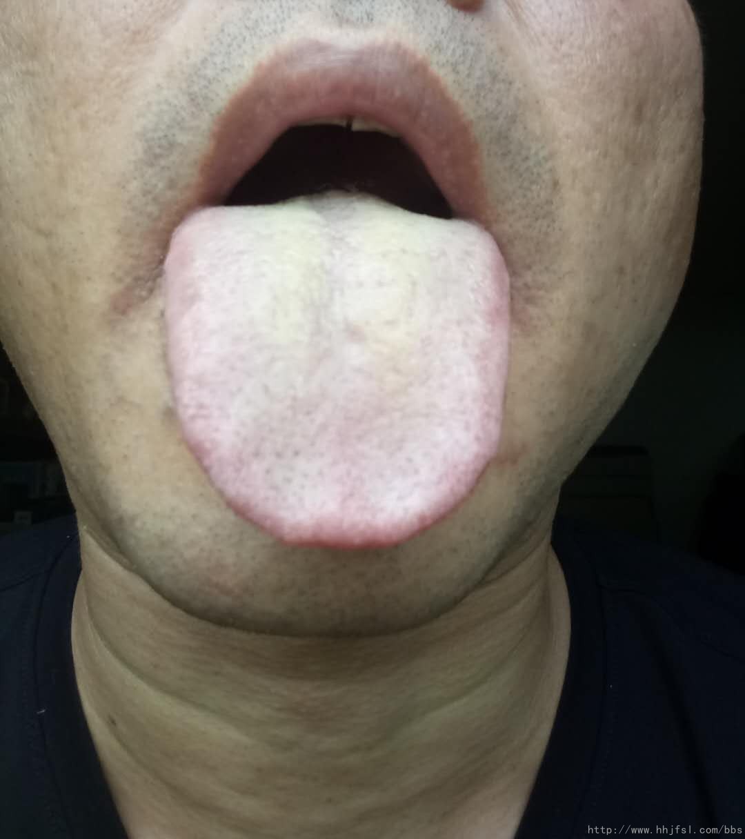 舌苔图1