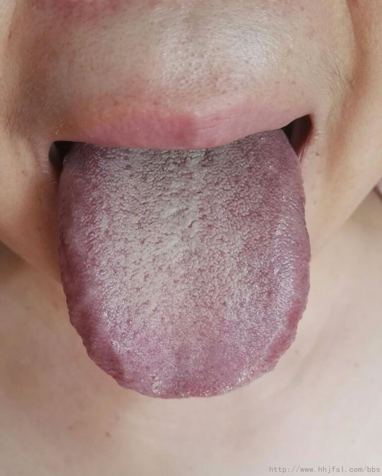 舌面.jpg