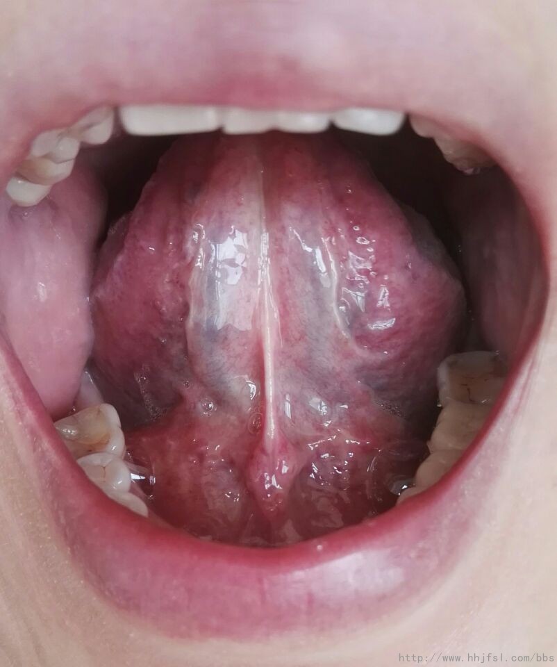 舌下.jpg