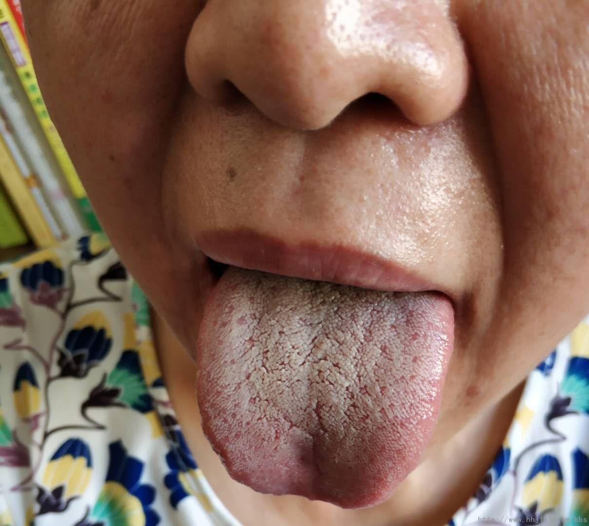 舌质与舌苔