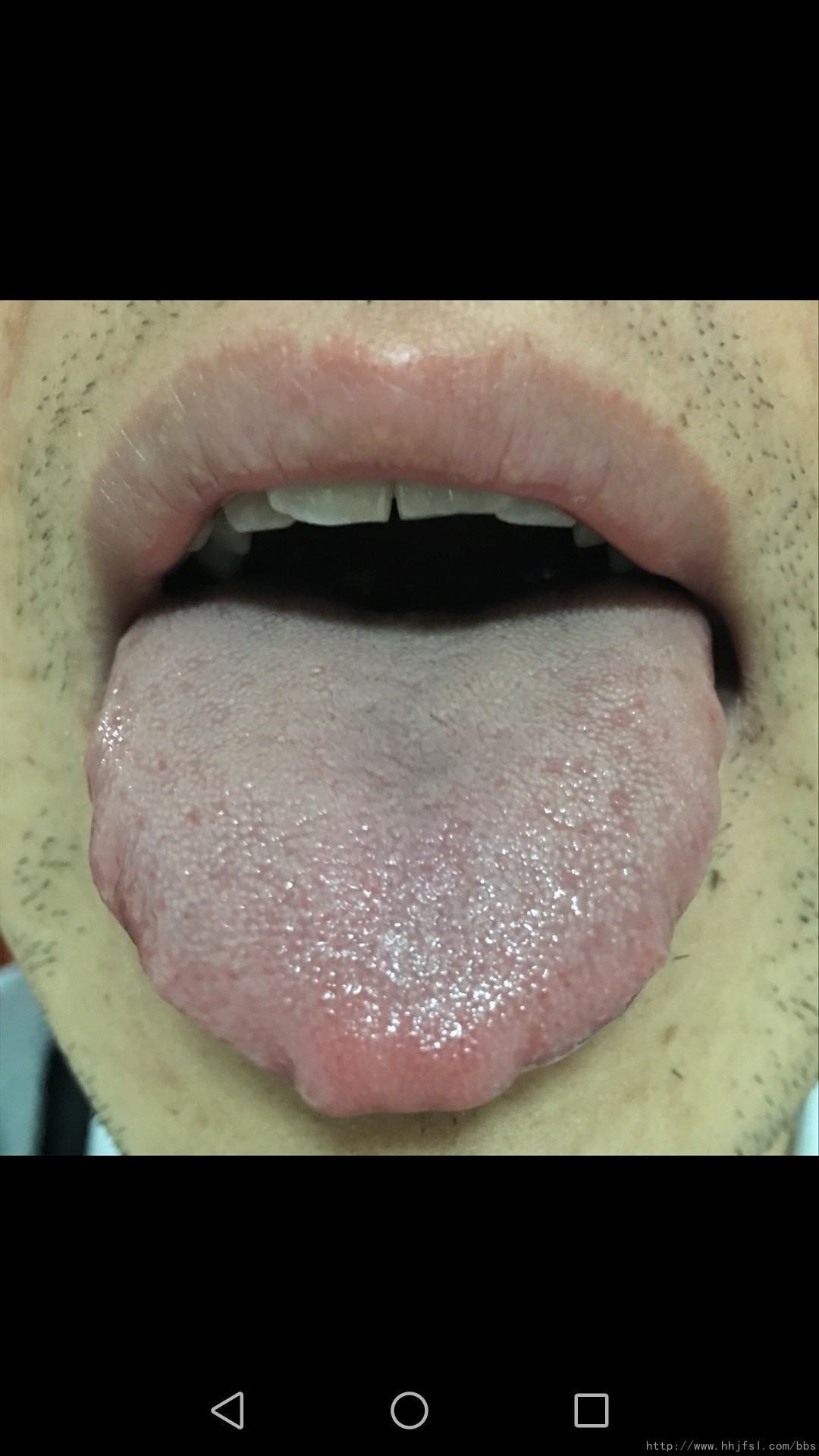 舌1