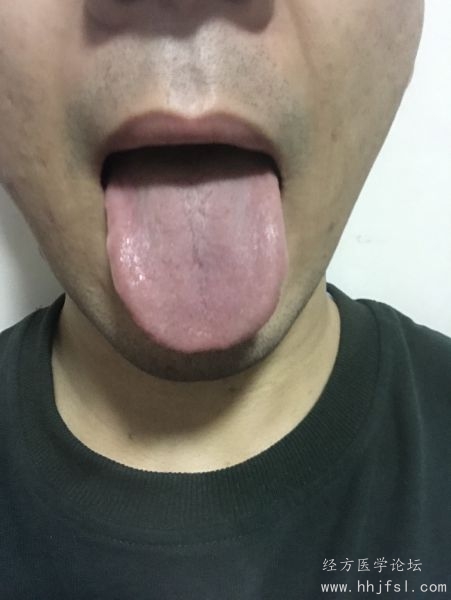 舌照