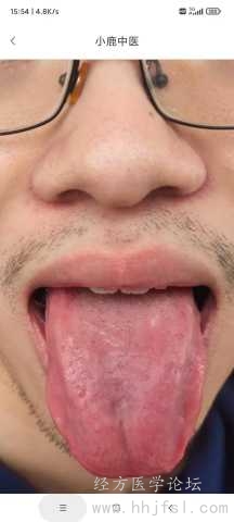舌诊照片.jpg