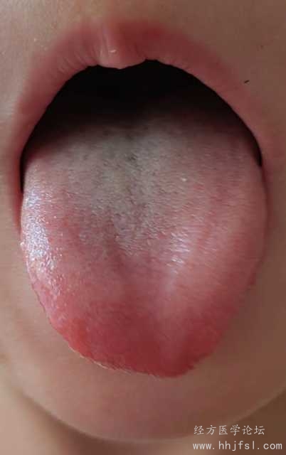 舌诊照片1.jpg