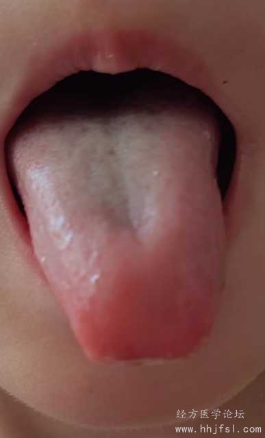 舌头诊照片2.jpg