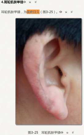 耳轮肌肤甲错，为血瘀日久（图3-25）.jpg