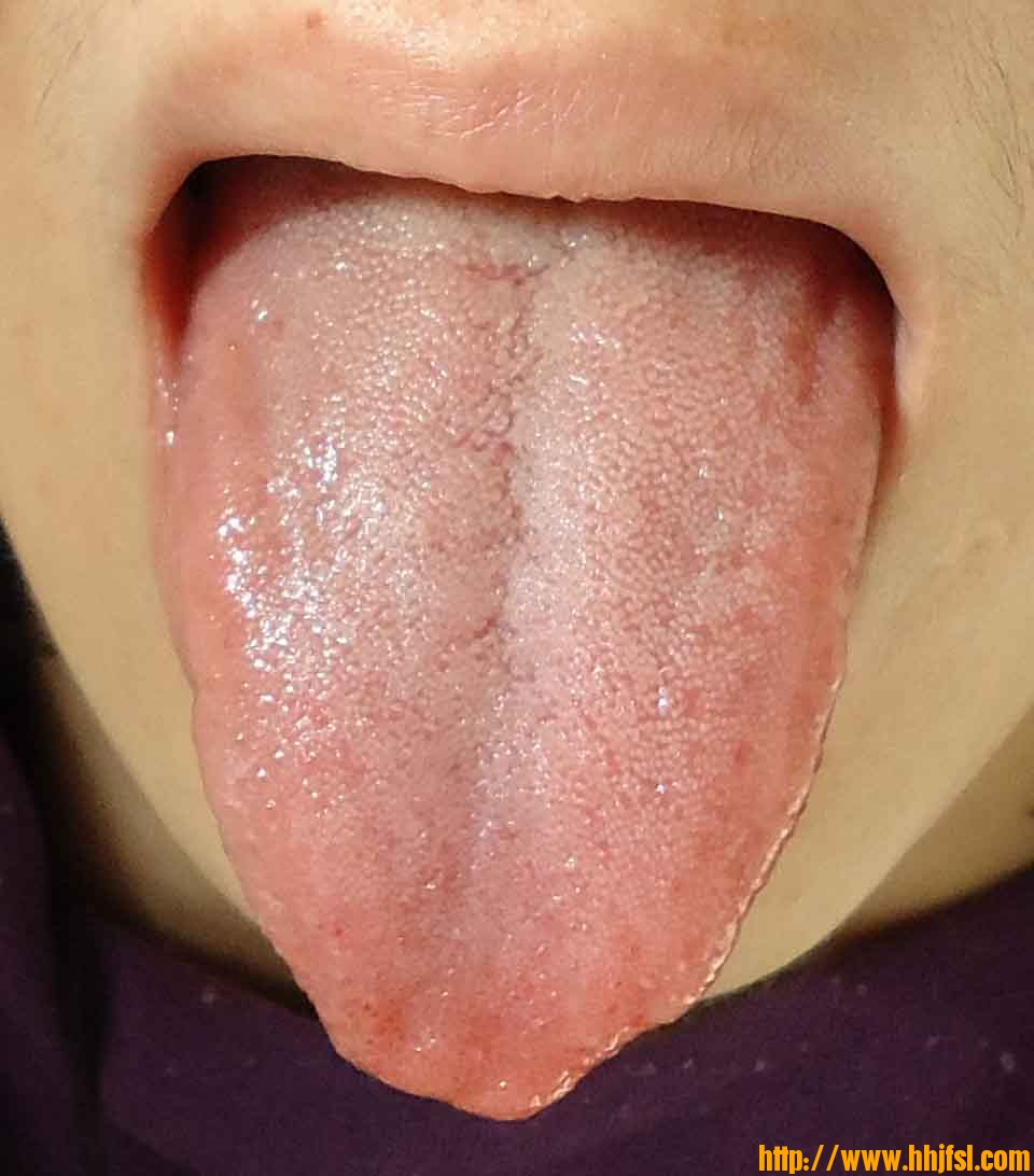 舌2.jpg