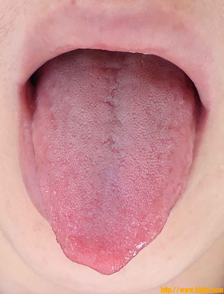 舌1.jpg