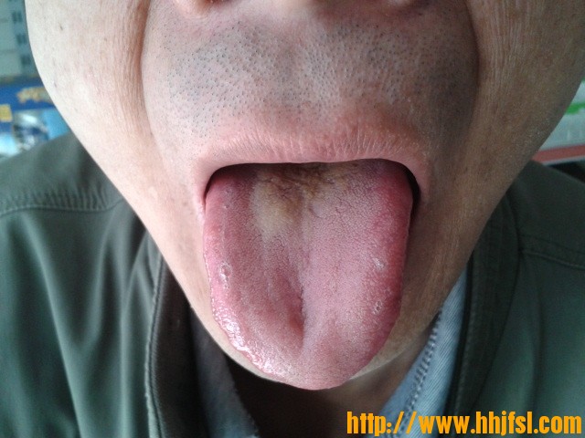 舌诊图