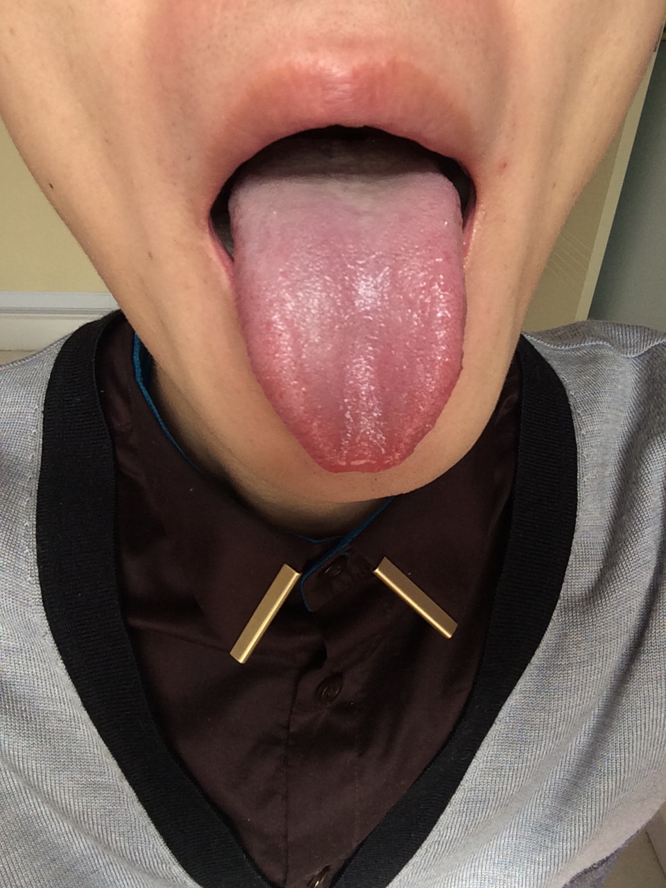 舌像