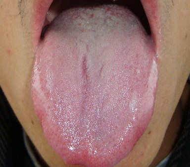 舌诊学样板图片
