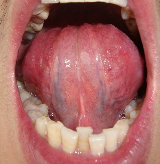 舌诊学样板图片